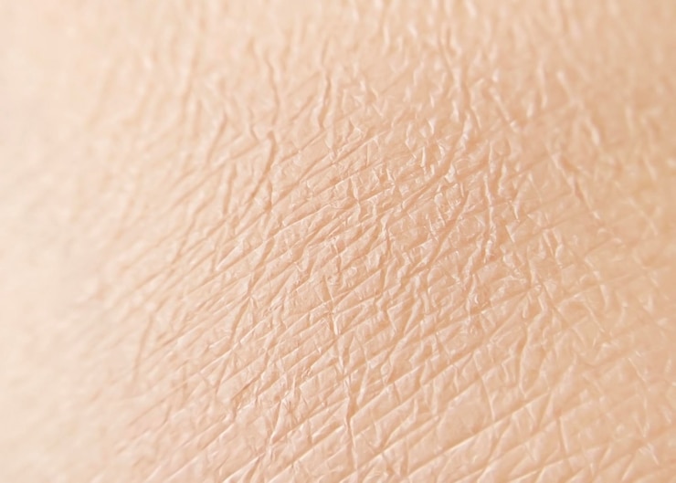 Photo texture de la peau humaine sèche en gros plan