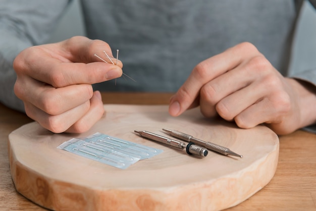 Traitement d'acupuncture sur les mains de l'homme, les aiguilles.