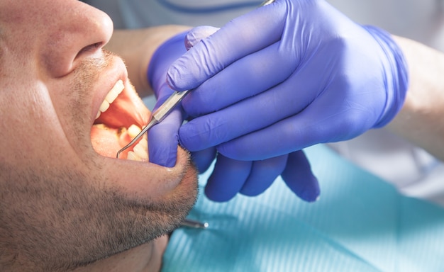 Travail de dentiste avec patient.