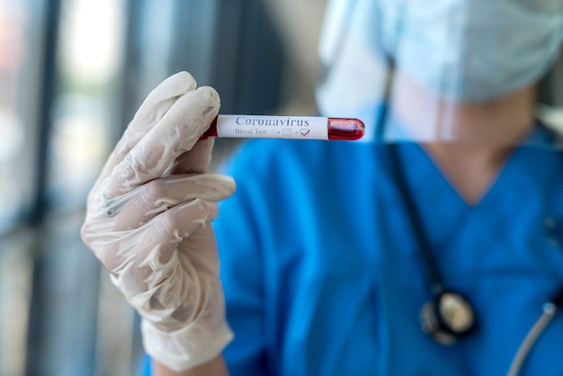 Un travailleur de la santé en gants de protection tient un tube à essai avec du sang, recevant un test positif pour le coronavirus