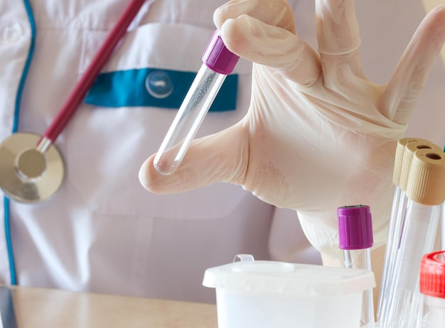 Tube à essai avec couvercle violet dans la main d'un technicien de laboratoire. fond blanc