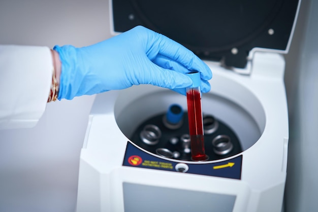 Photo tube à essai avec du sang et mélangeur
