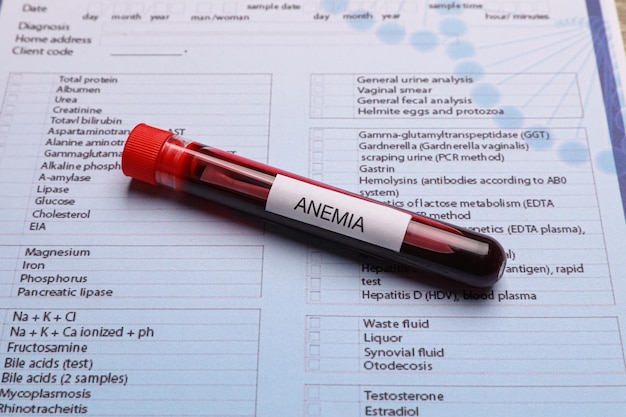Tube à essai avec échantillon de sang et étiquette Anémie sur formulaire médical