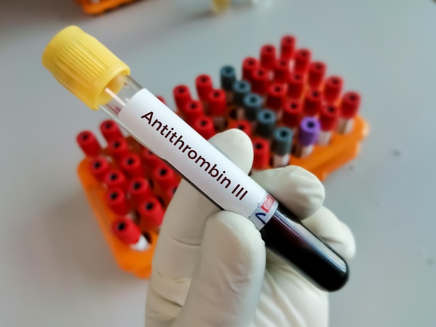 Tube de prélèvement sanguin pour le test antithrombine III pour le diagnostic des troubles de la coagulation