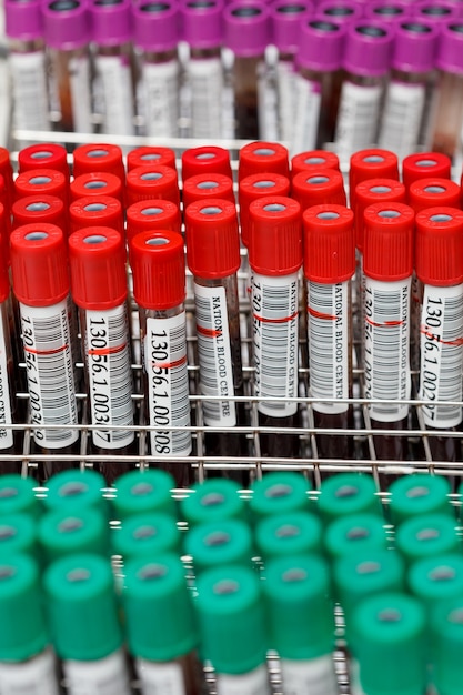 Tube de sang pour les tests en laboratoire Ã‚Â¸Ã‚Â™ratory