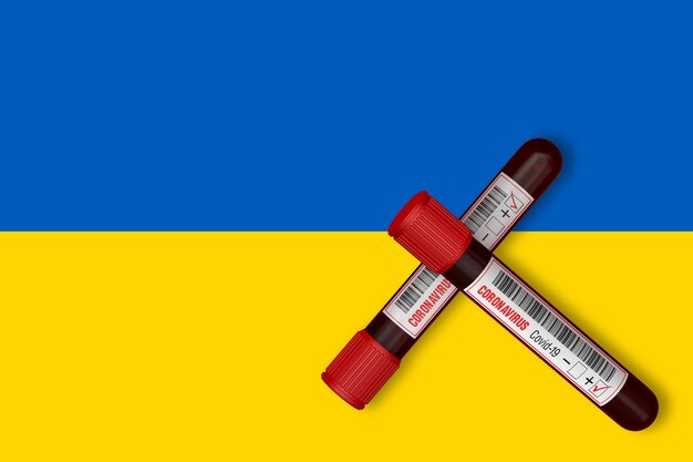 Tubes à essai avec l'inscription 2019-nCoV sur le fond du drapeau de l'Ukraine. Rendu 3D