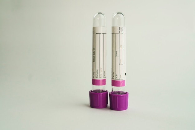 tubes à vide pour la collecte et les échantillons de sang sur fond blanc