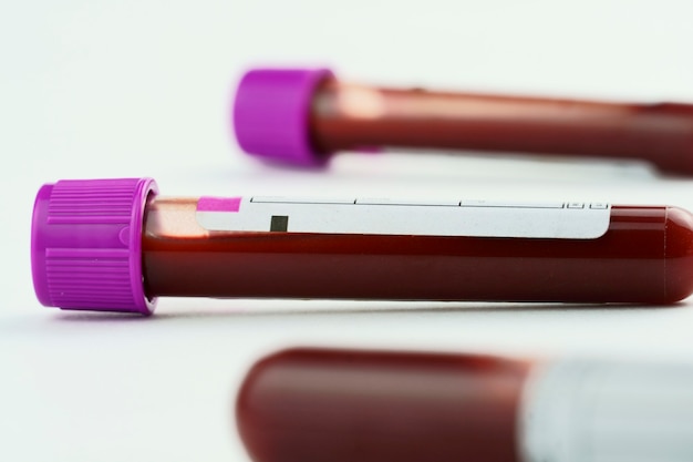 tubes à vide pour la collecte et les échantillons de sang et une seringue isolée sur fond de mise au point sélective