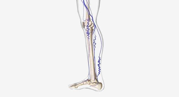 Photo varices dans la jambe humaine