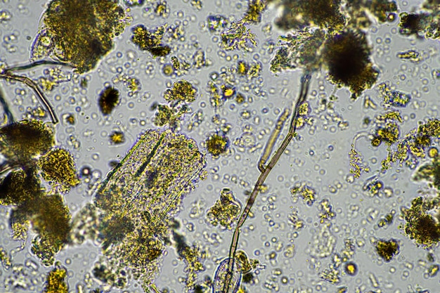 Ver microscopique dans le sol en Australie