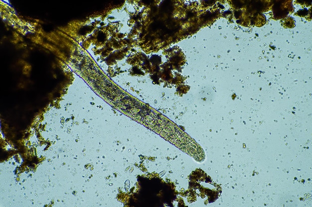 Vers du sol et insectes dans le compost