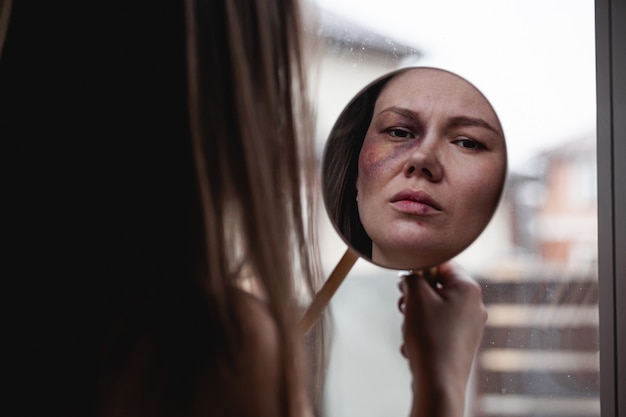 Violence domestique, femme maltraitée avec ecchymose au visage près de la fenêtre regarde dans le miroir