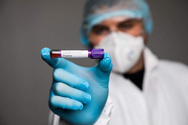 Virologue dans un masque médical et des vêtements de protection est titulaire d'un tube à essai avec un échantillon de sang positif pour les tests de coronavirus. Pandémie pandémique 19. Syndrome respiratoire, panique, expériences, recherche