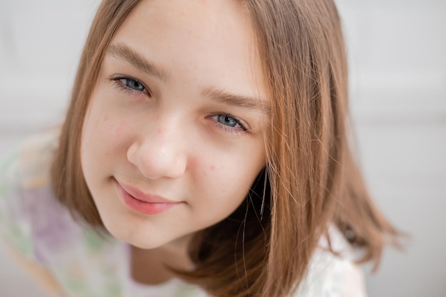 Visage d'une adolescente en gros plan. Adolescent à la peau problématique. Fille avec une coiffure carrée. Acné et cicatrices. Portrait naturel. Pas de maquillage et de retouche. Photo de haute qualité