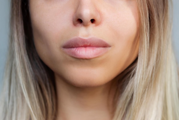 Photo visage de jeune femme blonde avec des lèvres parfaites après amélioration des lèvres résultat injection de mastic dans les lèvres