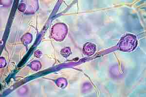 Photo visualisation des hyphas fongiques d'aspergillus dans un spécimen de bloc de cellules pulmonaires obtenu par lavage bronchoalvéolaire concept histopathologie pulmonaire infection par aspergillus hyphas fungiques lavage broncoalvéolaires