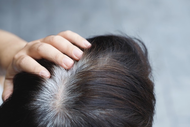 Vue arrière des jeunes cheveux gris prématurés montrant des racines de cheveux noirs sur le changement de tête en vieil homme senior en plein air