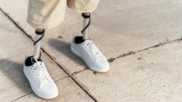 Vue d'un homme avec des jambes prothétiques et des baskets blanches