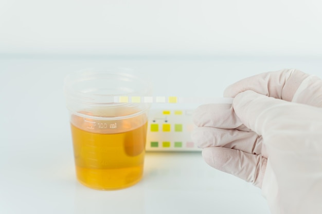 Vue rapprochée de la bande tenue à la main par un échantillon d'urine sur fond blanc