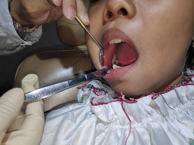 Photo vue rapprochée d'un dentiste examinant les dents d'une fille