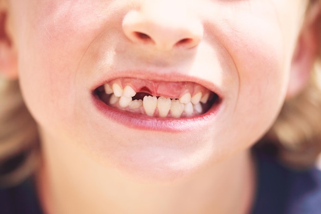 Vue rapprochée du garçon aux dents creuses