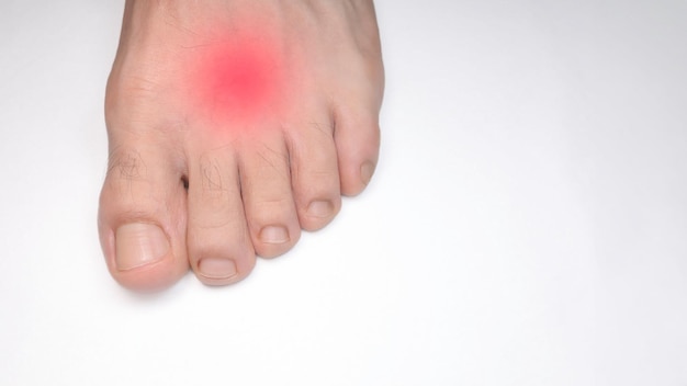Vue rapprochée du pied gauche d'une personne avec une marque rouge représentant la douleur
