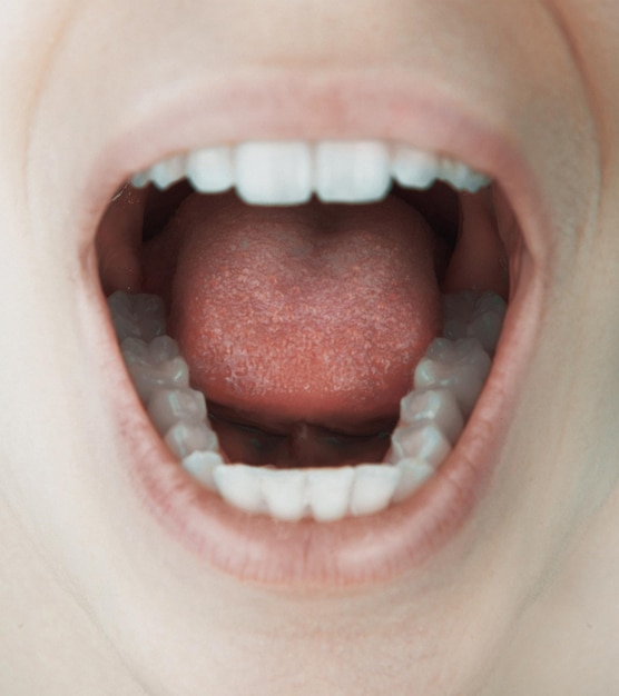 Vue rapprochée d'une femme avec la bouche ouverte