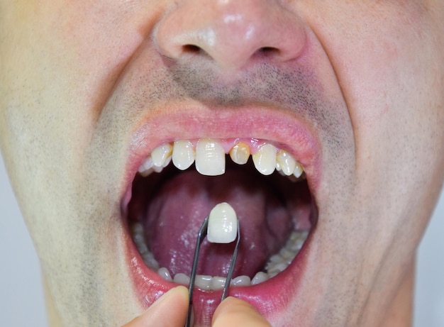 Photo vue rapprochée d'un homme tenant des dents