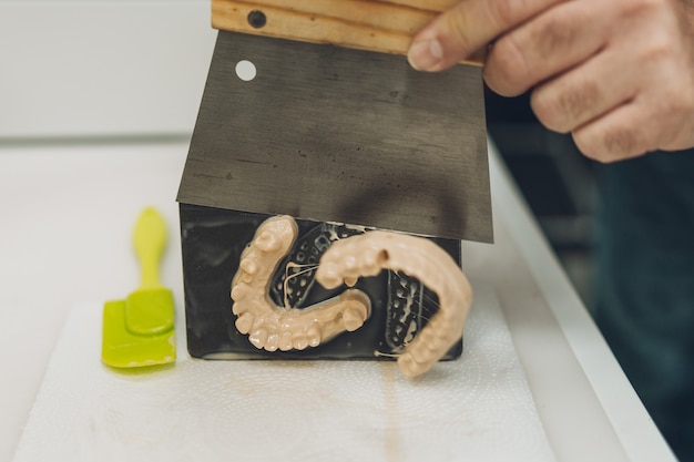 Vue rapprochée des mains d'un homme adulte de race blanche détachant un moule réalisé avec une imprimante 3D de la base de la machine dans un laboratoire spécialisé dans la création de couronnes en porcelaine