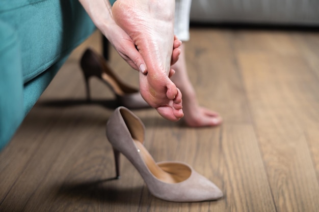 Vue rapprochée des pieds d'une femme avec des callus problème de santé de mauvaises chaussures douleur dans les pieds