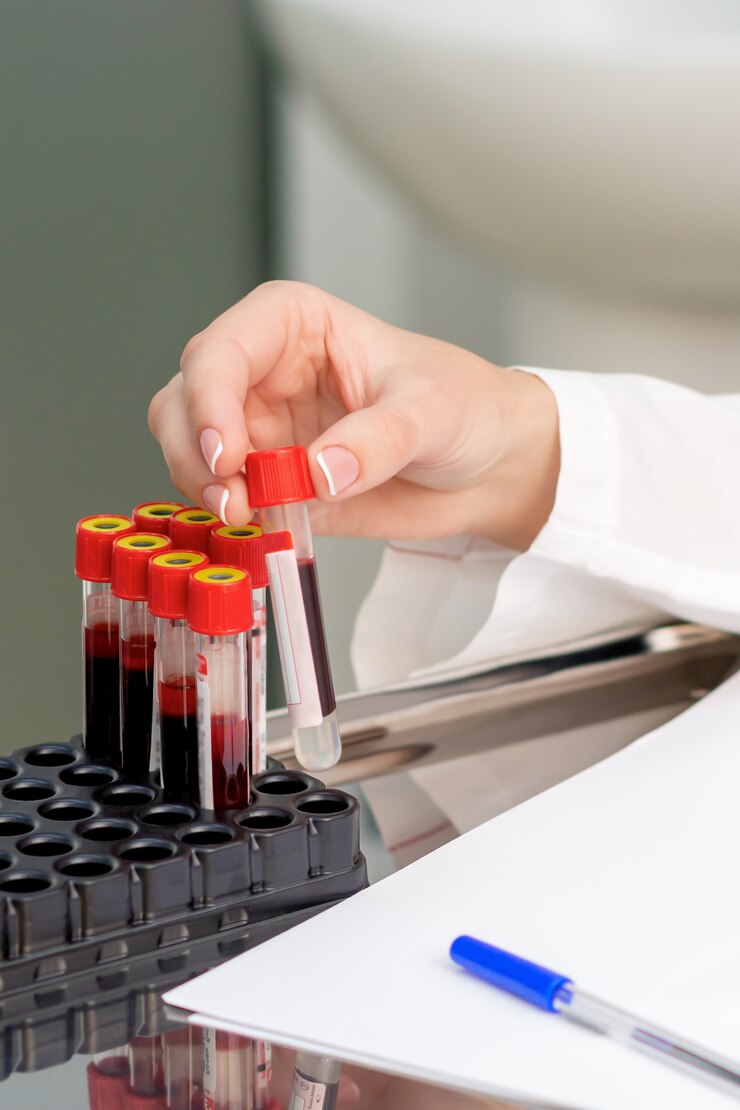 Fotoğraf blood sample tubes in hands