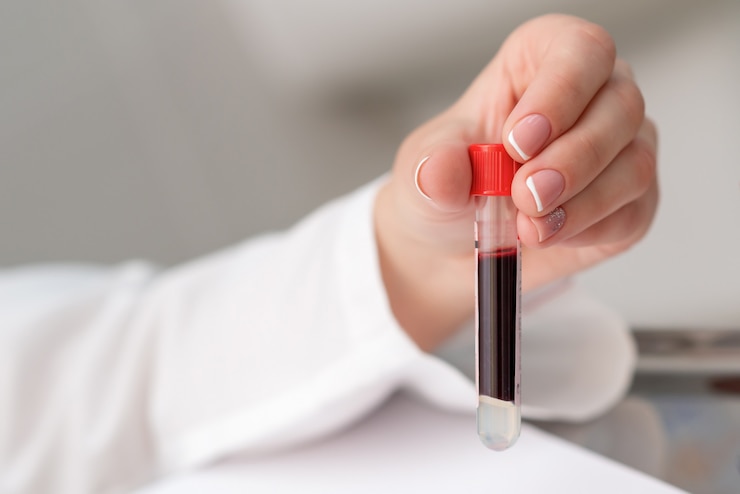 Fotoğraf blood sample tubes in hands