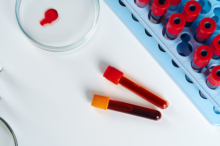 Fotoğraf blood test analysis with petri dish close up
