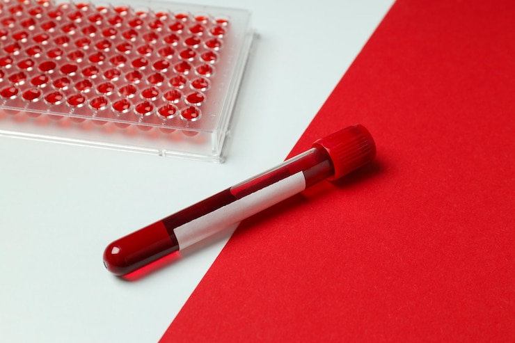 Fotoğraf human blood in test tubes on the table