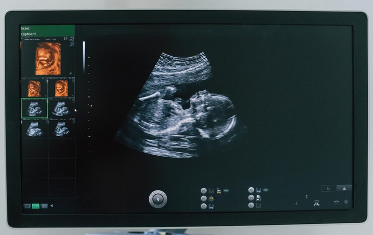Fotoğraf pregnant baby infant ultrasound display conception of health care