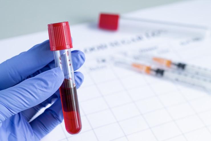 Fotoğraf test için hazır kırmızı kan plazması olan test tüpünü tutan doktorun eli
