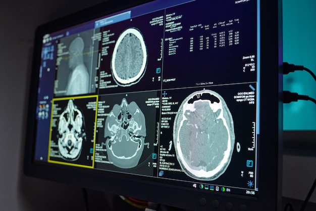 Displaying Medical Imaging Results on Advanced Screen