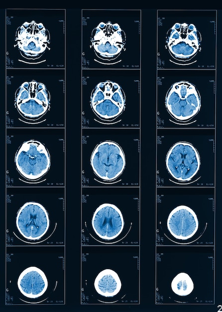 Full frame shot of medical x-ray