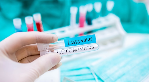 Foto provette per l'epidemia 2020 con febbre di lassa e coronavirus