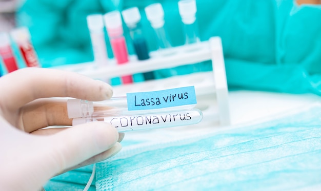 2020 epidemic test tubes with Lassa fever and coronavirus