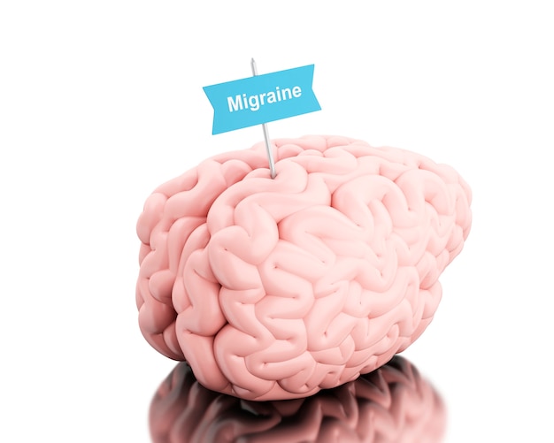 3D-hersenen met een bord en woord migraine.