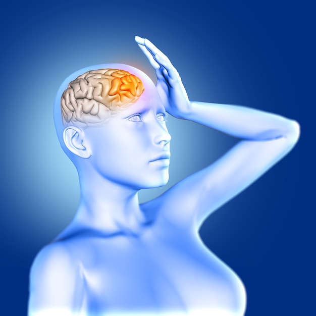 3D render of a blue female medical figure in pain with brain highlighted