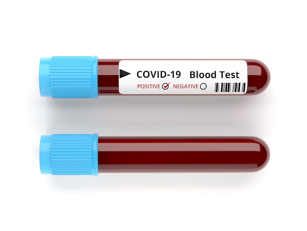 3d render Covid-19 Blood test concept, Blood tube test isolate . Clipping path