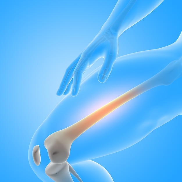 大腿骨のクローズアップを使用した医療男性フィギュアの3Dレンダリング