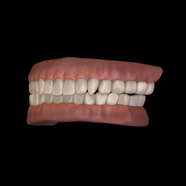 Фото 3d-рендеринг человеческой челюсти с черными треугольниками между зубами