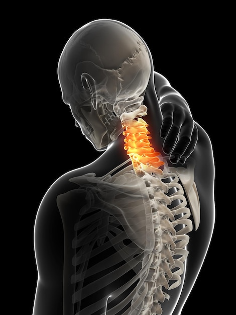 3d rendered illustration painful neck
