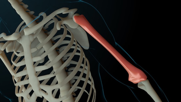 3d rendered illustration of skeleton structure with injured bones. Bone pain is shown by red glow. Pain in arm section.