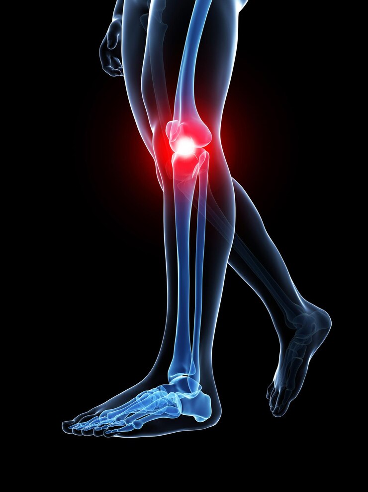 Photo 3d rendered medical illustration painful knee