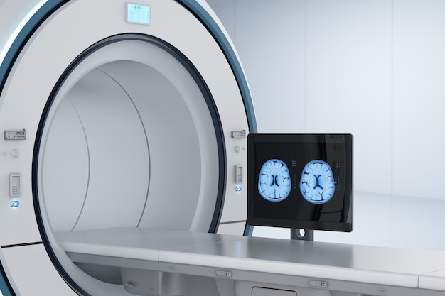 사진 3d 렌더링 컴퓨터 모니터는 mri 실험실에서 x선 뇌를 표시합니다.