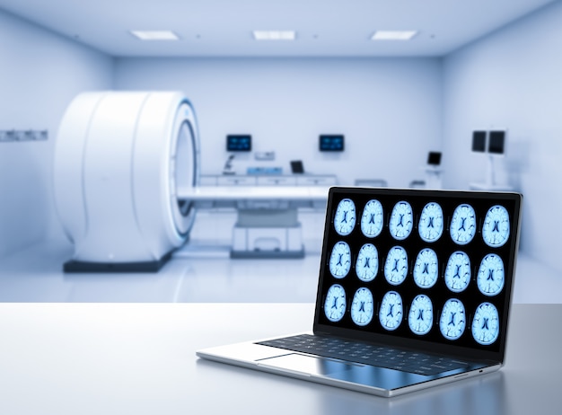 3d rendering computer notebook display x-ray brain in mri lab